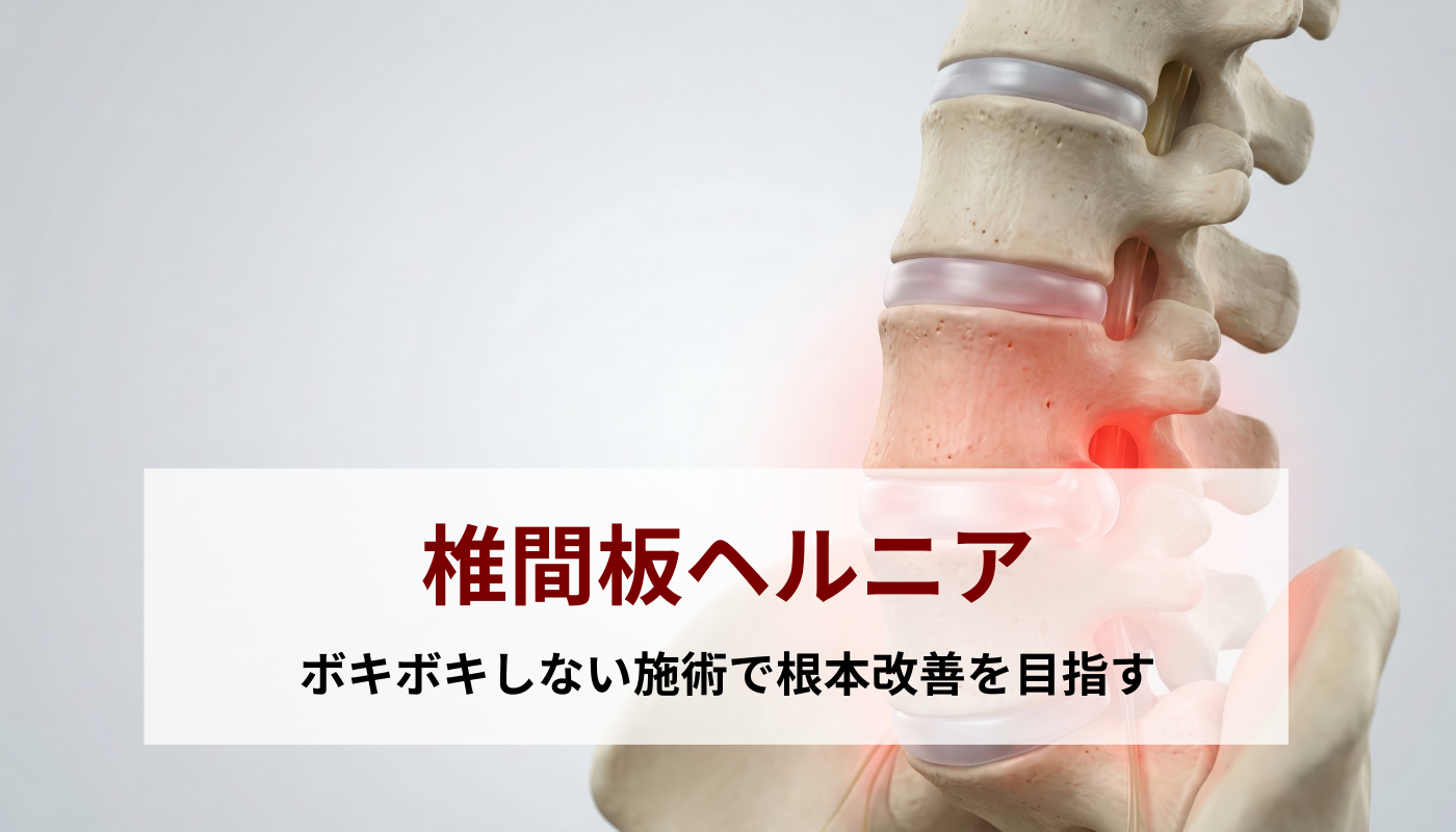 椎間板ヘルニア｜柴田骨格矯正｜銚子市